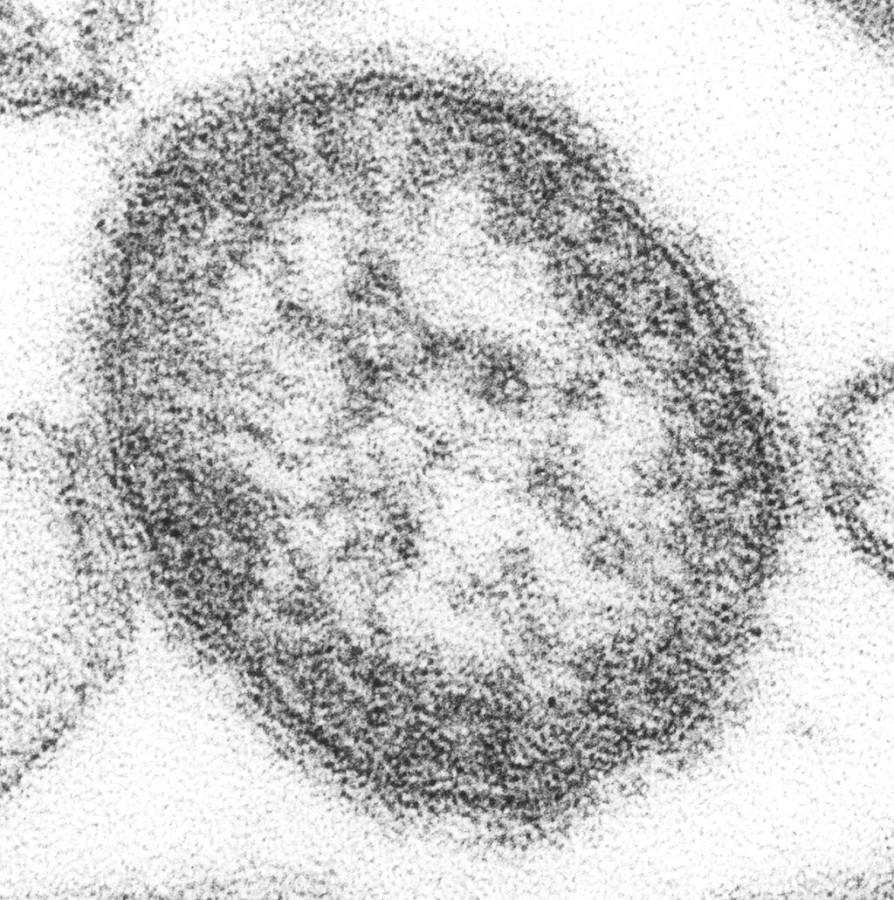 Slide+of+Measles+virus.+Photo+Credit%3A+Cynthia+S.+Goldsmith+%2F+CDC%2F++William+Bellini%2C+Ph.D.+%5BPublic+domain%5D%2C+via+Wikimedia+Commons